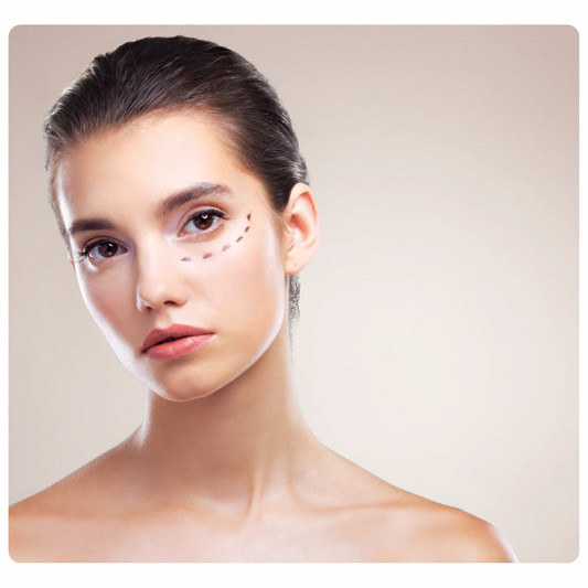 Redermalización de Ojeras